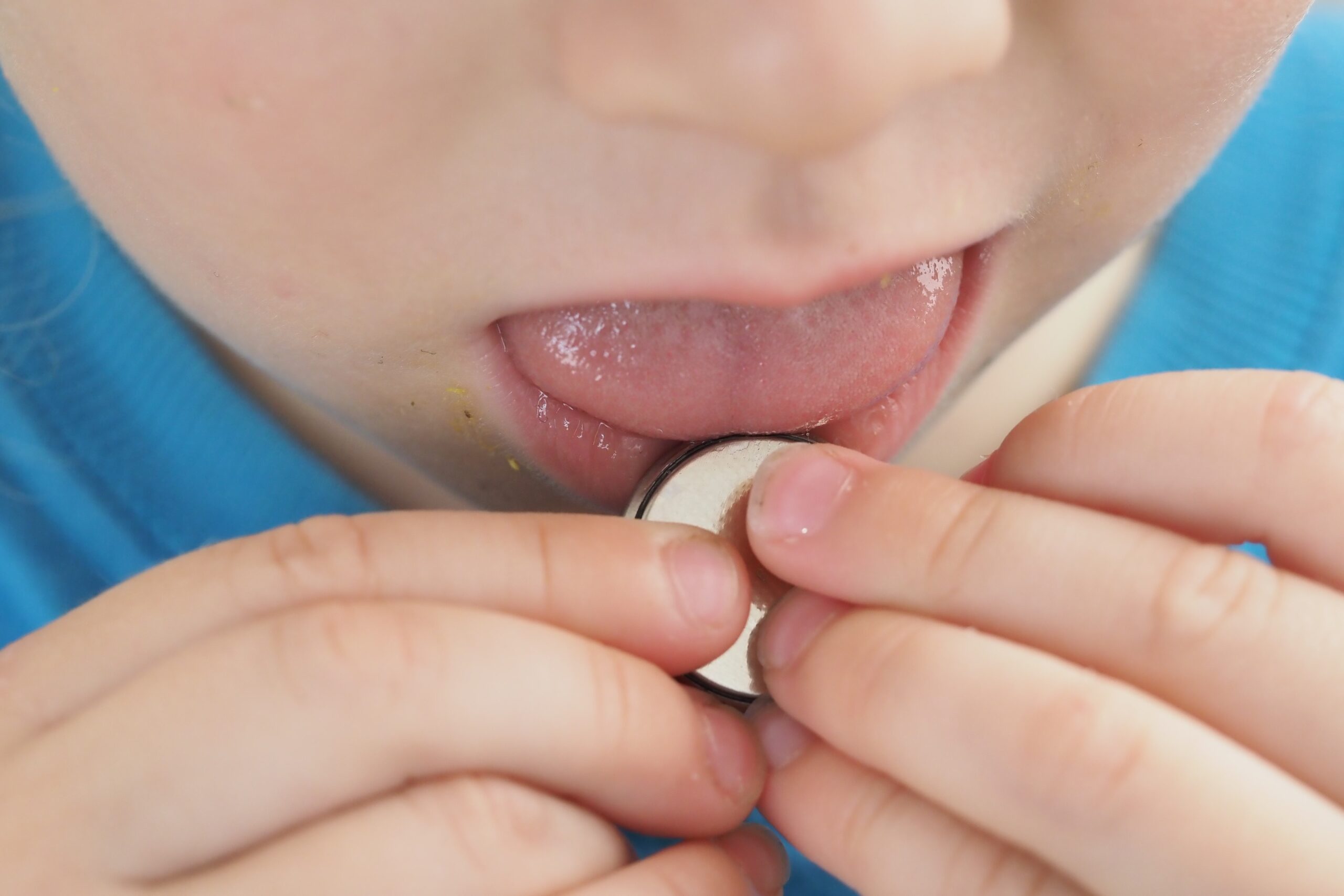 Child and Adolescent Safety coin cell battery ingestion 2