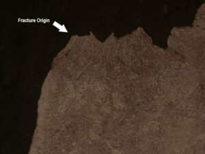 A high magnification optical microscopic view of the longitudinal cross-section at the fracture origin exhibits evidence of brittle intergranular fracture. No unusual conditions are observed in the martensitic microstructure.